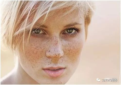 脸上色斑越来越多该怎么淡化色斑,色斑的解决方案