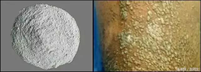 舌尖上的医疗,舌尖上的医疗篇