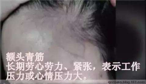 青筋的手诊方法,全身青筋诊病全集