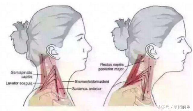 腰痛可以练习仰卧起坐恢复吗,腰椎管狭窄能练仰卧起坐么