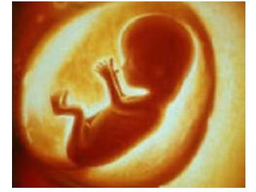 孕妇做四维彩超发现羊水少怎么办,39周产检羊水少胎心低