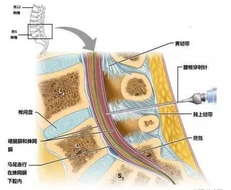 绘制神经系统的生理解剖图,人体骨骼血管神经系统解剖图