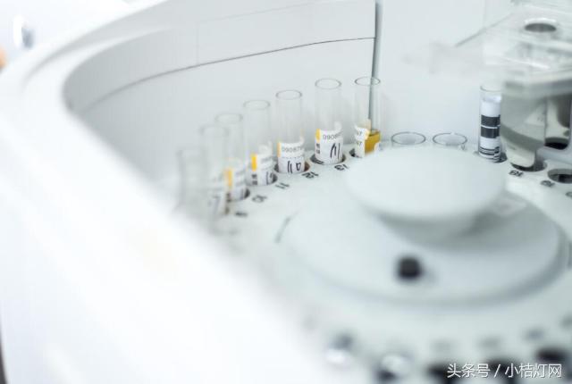 ivd应用领域分析,ivd产品知识