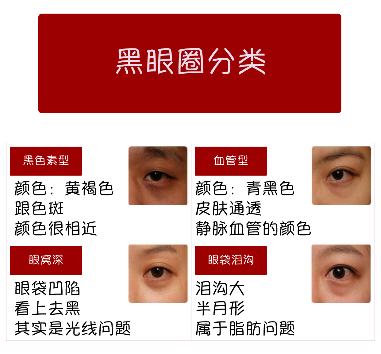 鱼子酱淡化泪沟眼袋黑眼圈眼霜,淡化黑眼圈眼袋泪沟哪个眼霜好