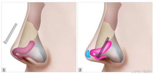 甜美少女养成计——俊翘美鼻