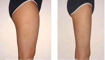 75年女性现在绝经正常吗,女性46岁绝经前的症状