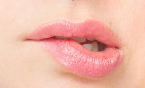 唇部干燥起皮是什么病,唇部干燥起皮怎么护理