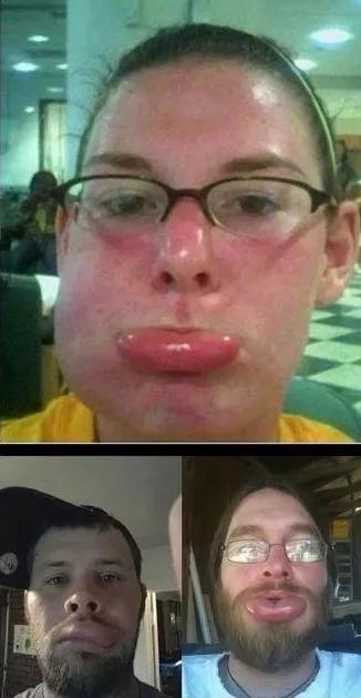 哈哈哈，原谅我拖拉机般的笑声！当喵星人被蜜蜂蜇了之后