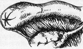 明明是不孕，医生还要切除我的输卵管！