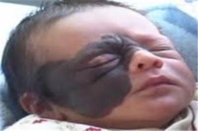 32岁产妇生下怪婴全身长黑毛,孕妇生下七头怪婴