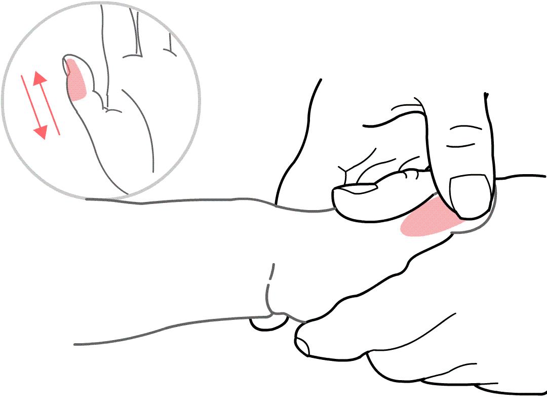 eb病毒发烧39度多怎么办,eb病毒反复发烧15天了