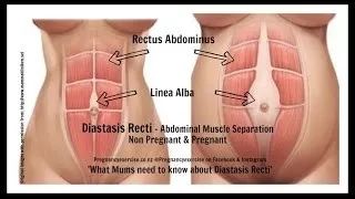 孕妇妈咪的运动指南（二）