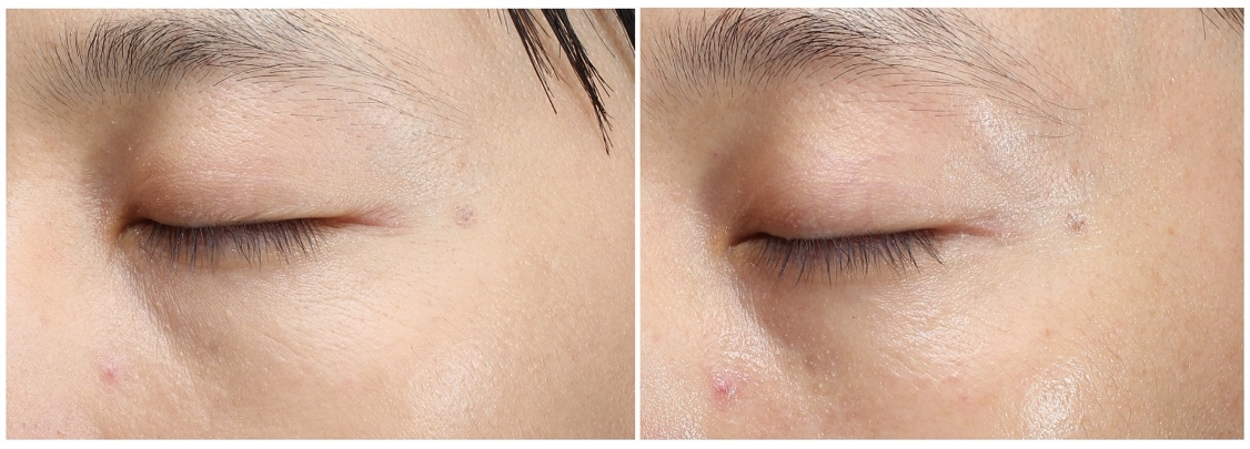 如何恢复美肌YOUNG动能？靠谱的刘东阳为你揭秘这个答案