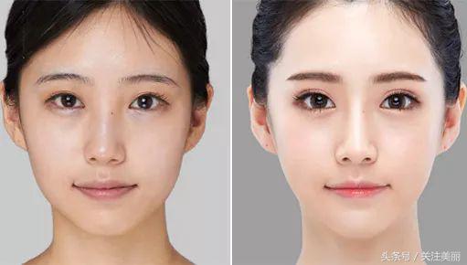 打完瘦脸针多久可以吃阿莫西林,打完除皱瘦脸针多久能洗脸敷面膜