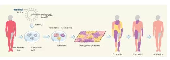 基因治疗遗传病会实现吗,基因治疗可以根治遗传病