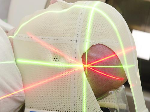 放疗治疗范围有哪些,放疗主要针对的病