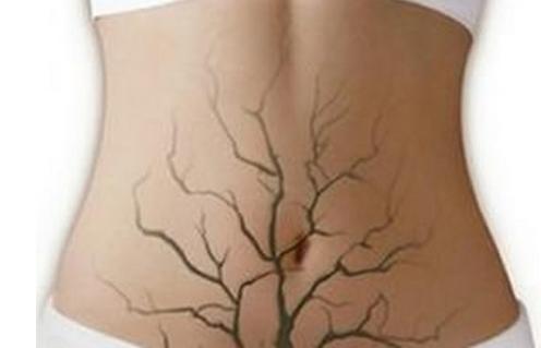 宫寒怎么治女生,宫寒会导致哪些身体状况