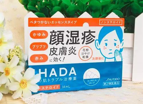 又到了一年一度柳絮过敏的季节,又到了柳絮泛滥的季节过敏怎么办