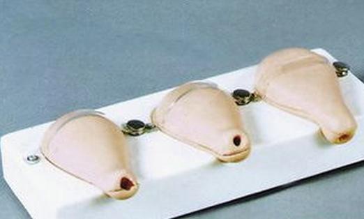 人流手术的真实经历,在医院做人流手术辞职