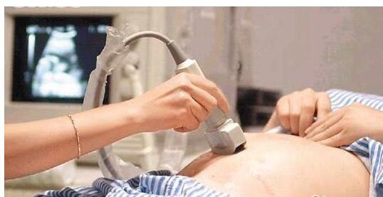 产检的十个建议,产检必须知道的16件事