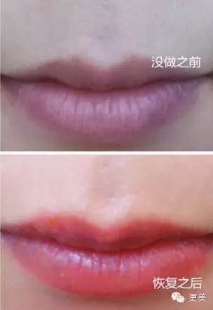 韩式半永久,韩式半永久都有什么