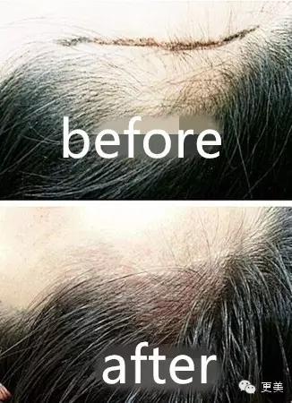 韩式半永久,韩式半永久都有什么