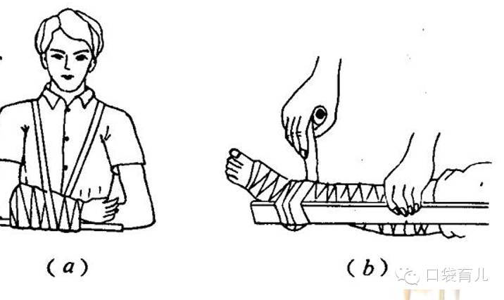 小儿外伤怎么护理,小朋友外伤怎么护理
