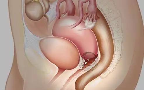 妇科主任给女性的10大建议,妇科医生个人总结