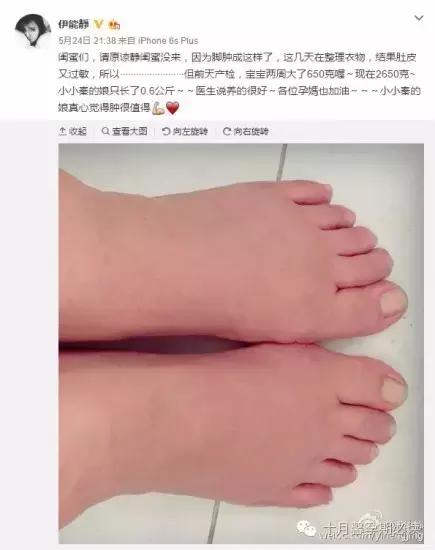 孕期扭到脚肿了怎么办,孕期手麻脚肿怎么缓解