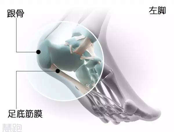 全球治好足跟痛,足底疗法治百病