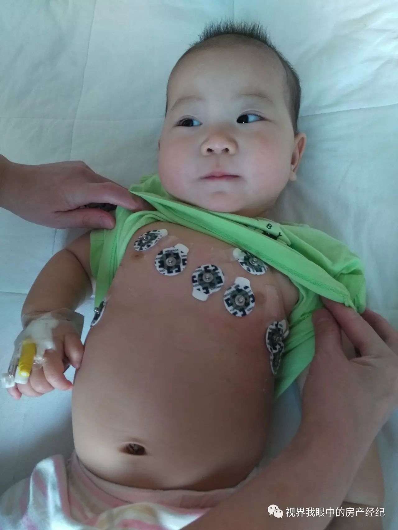 川崎病恢复期怎么预防感冒,川崎病当成感冒会出什么问题