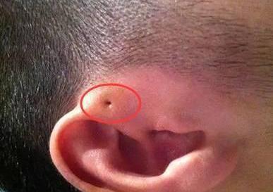 仓眼为什么是黑色,为什么会有仓眼