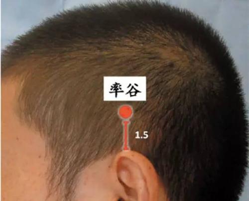 头痛痛的受不了睡不着怎么办,头痛受不了