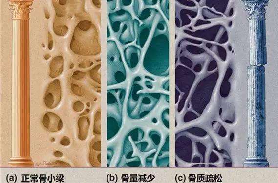 骨胶原蛋白肽对关节炎的作用,胶原蛋白治骨质疏松效果怎样