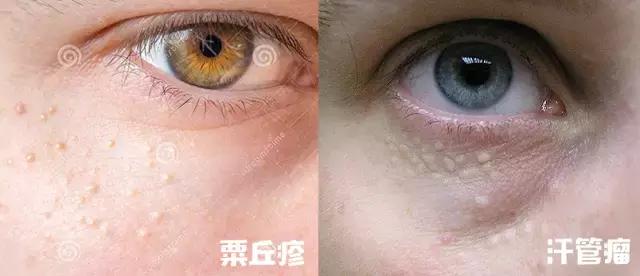 辟谣护肤界盛传的谣言,辟谣这9条护肤谣言真是害人不浅