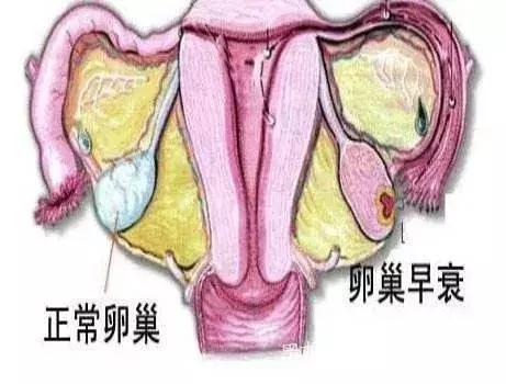 月经不调是排卵障碍吗,月经不调排卵也会不正常吗