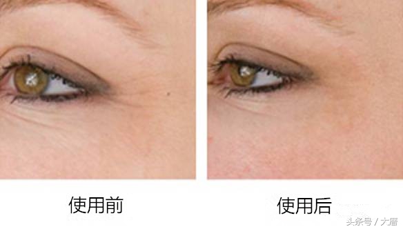 热门的美容仪真的好用吗,大几千的爆款美容仪真的值得吗