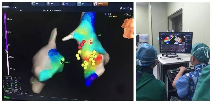 北京清华长庚心血管内科,北京清华长庚心血管专家