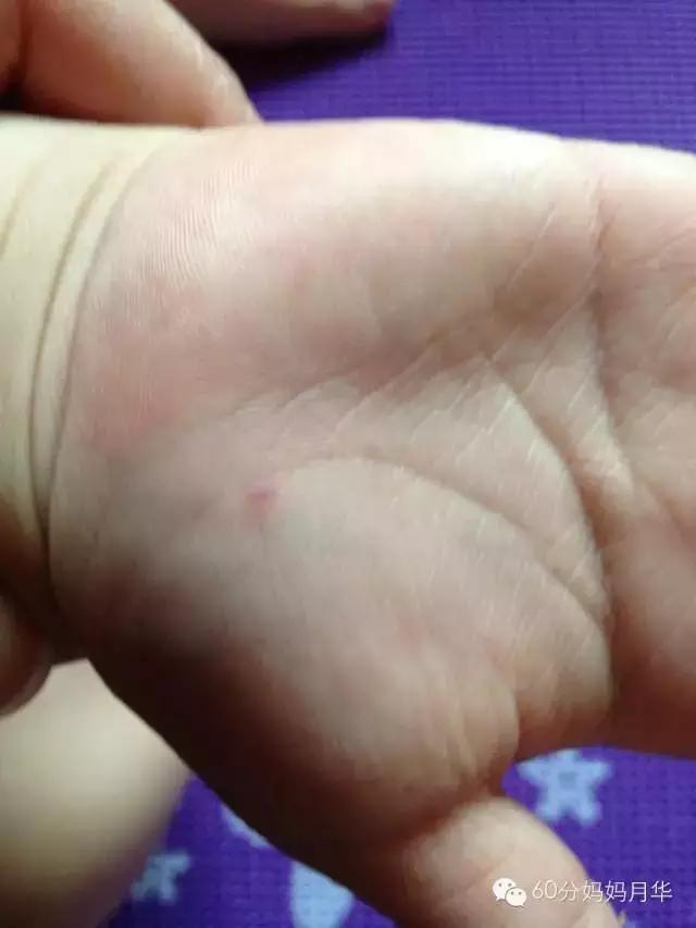 手足口是否要勤洗手,手足口病高发期宝宝如何预防