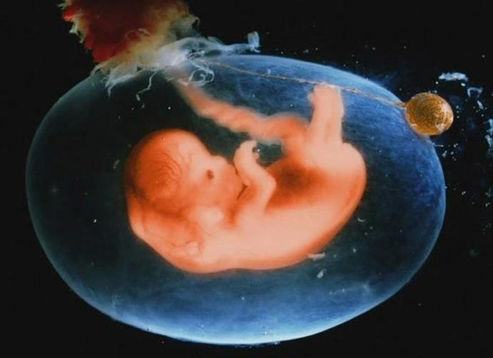 孕期羊水过多或过少的原因有哪些,羊水太少胎儿会怎么办