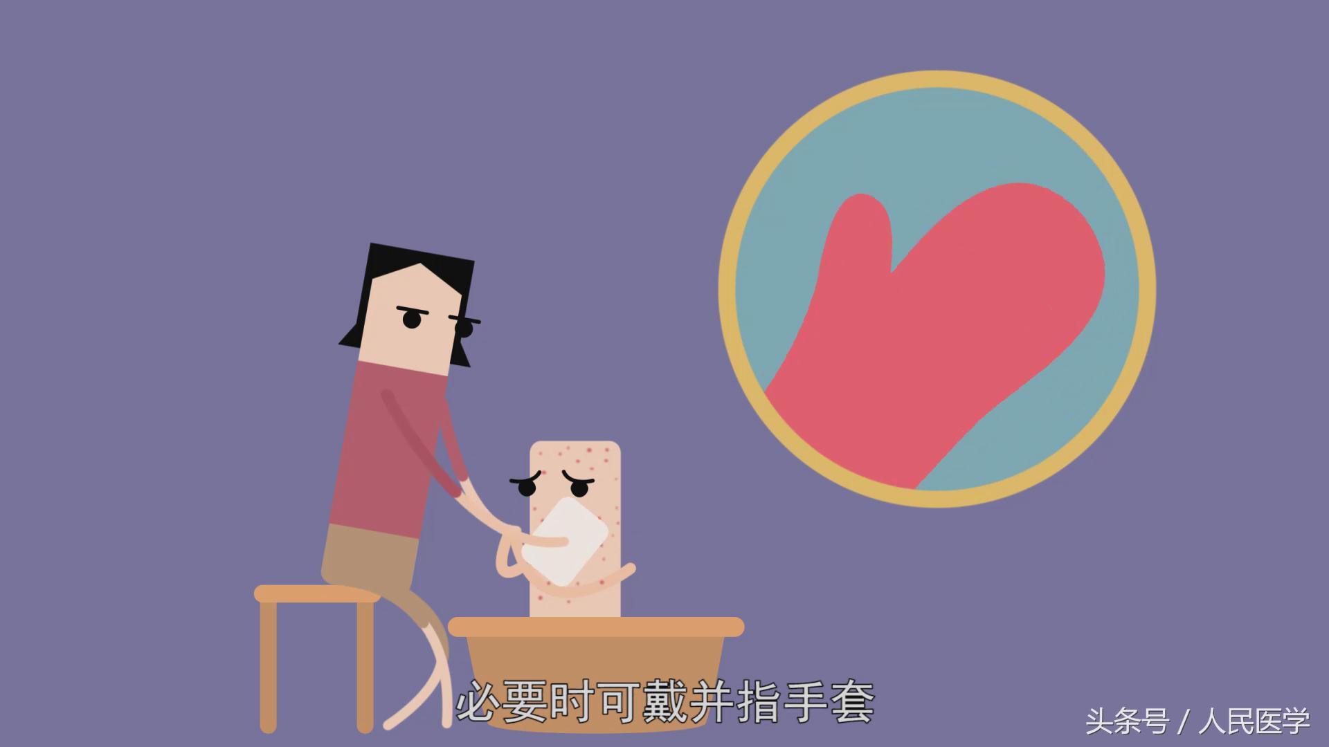 学校水痘疫情处置方案,学校水痘疫情