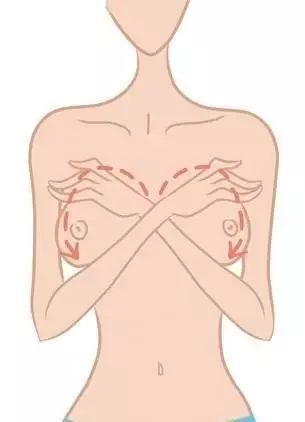 生娃后乳房下垂怎么恢复,预防乳房下垂的方法