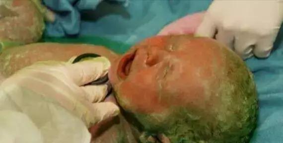 孕妇怀孕8个月伤心哭,孕妇怀胎八个月