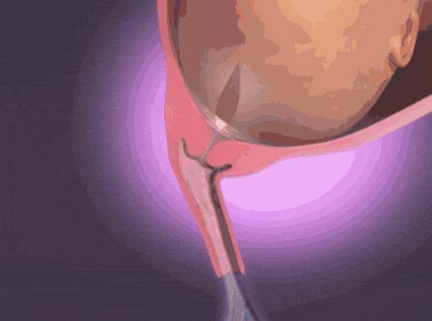 生孩子太慢对胎儿有什么影响,生孩子产程太长会导致宝宝缺氧吗