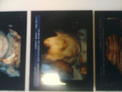 一胎保胎心路历程,揭秘我的艰难怀孕之路