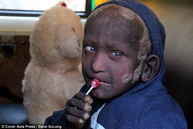 小男孩一出生无鼻无耳无眼,小男孩一出生奇丑无比