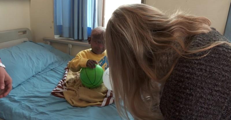 小男孩一出生无鼻无耳无眼,小男孩一出生奇丑无比