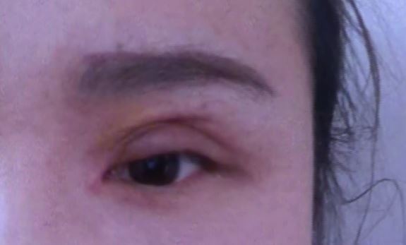 警惕非法医疗美容,非法医疗美容行业