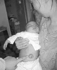 新生儿肚脐5个异常要注意！这篇宝宝脐部护理攻略送给月嫂！