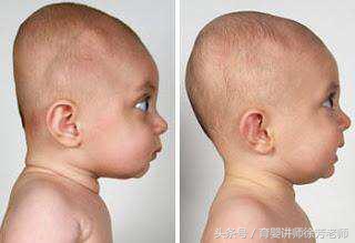 小孩睡偏头会影响智力吗,睡觉睡成偏头影响智力吗